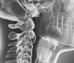 CÁNCER DE  CABEZA Y CUELLO #3